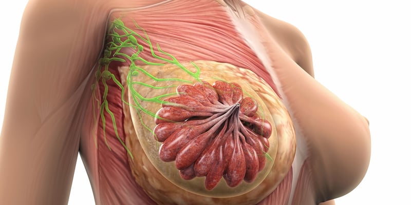 乳腺癌相关淋巴水肿怎么办：症状分期与居家管理要点