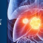 胆管癌新疗法：siRNA纳米靶向递送带来什么希望