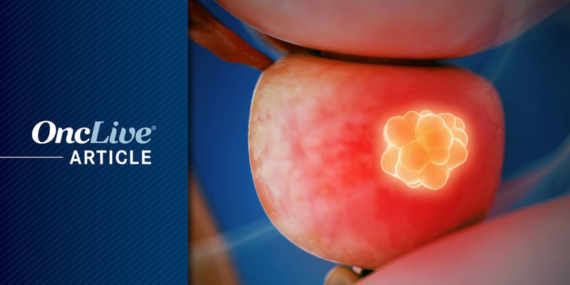 中危前列腺癌放疗联合瑞卢戈利：疗效与副作用全解