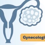 卡度尼利单抗治疗复发/转移宫颈癌：长期生存数据与用药要点