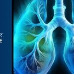 EGFR exon20插入肺癌一线治疗怎么选：Sunvozertinib对比化疗关键信息