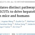 肝母细胞瘤为何容易复发进展？YAP与β-Catenin分工揭秘与ONECUT1新线索