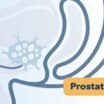 HRR突变mCSPC治疗新进展：他拉唑帕利联合恩扎卢胺