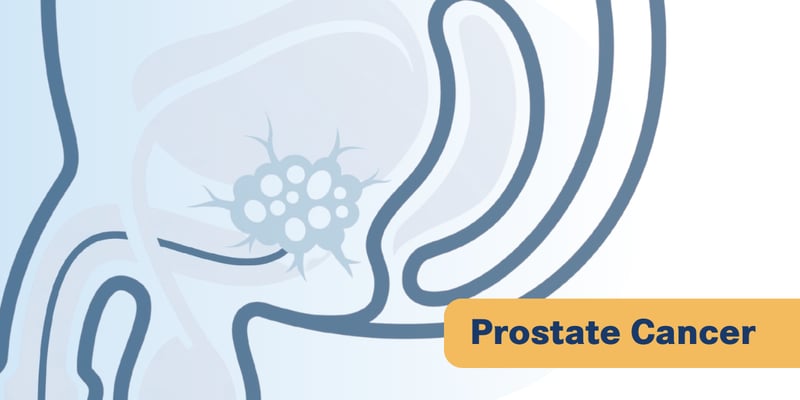 HRR突变mCSPC治疗新进展：他拉唑帕利联合恩扎卢胺