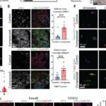 乳腺癌为什么“越挤越凶”？PIEZO1压力传感器揭示早期侵袭与转移新线索