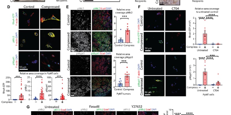 乳腺癌为什么“越挤越凶”？PIEZO1压力传感器揭示早期侵袭与转移新线索