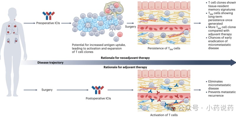 辅助与围手术期免疫治疗怎么选？PD-1/PD-L1在肺癌等可切除肿瘤的证据与策略