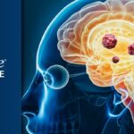 儿童幕上室管膜瘤为何易复发？一文看懂肿瘤“细胞社区”与治疗新方向