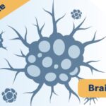 高级别胶质瘤新疗法：伊立替康植入剂进展解读