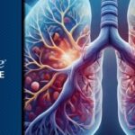 非小细胞肺癌免疫治疗：肿瘤-免疫空间生态如何预测帕博利珠单抗疗效