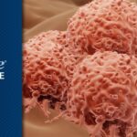 高危II期黑色素瘤术后辅助帕博利珠单抗：复发风险、副作用与随访要点