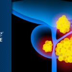 HRR突变mCSPC新方案：他拉唑帕利联合恩扎卢胺解读
