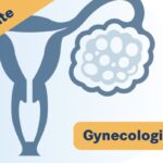 尼拉帕利治疗卵巢癌：MyChoice CDx检测HRD阳性用药指南