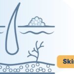 黑色素瘤要不要做前哨淋巴结活检？最新前瞻性研究给出更精准答案