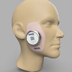 非黑色素瘤皮肤癌放疗新选择：OncoPatch适合谁