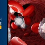 滤泡性淋巴瘤三线治疗怎么选？利基迈仑赛长期疗效与副作用全解析