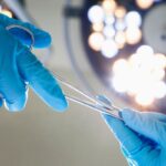 肿瘤多学科治疗怎么选：放疗、手术与胰腺癌前沿方案全解析