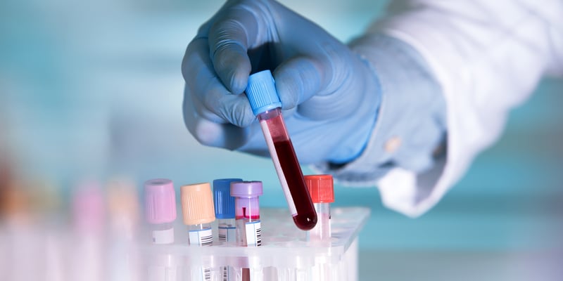 林奇综合征癌症风险怎么查？血液生物标志物与早期筛查全解析