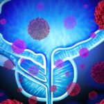 前列腺癌尿液活检准确吗？97.8%敏感性数据、PSA对比与就诊决策