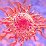胰腺癌复发有救了？个性化mRNA疫苗6年随访：87.5%响应者依然生存！