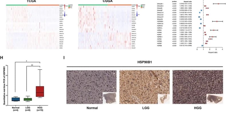 脑胶质瘤放疗耐药、易复发怎么办？科学家揭示关键靶点HSP90B1，前沿靶向治疗迎来新突破