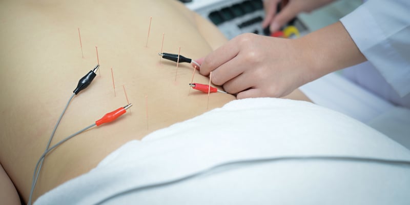 乳腺癌康复后脑雾失眠焦虑怎么办？电针治疗证据解读