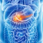 胰腺癌新药Daraxonrasib获FDA扩大可及：生存期几近翻倍，晚期患者迎来新曙光