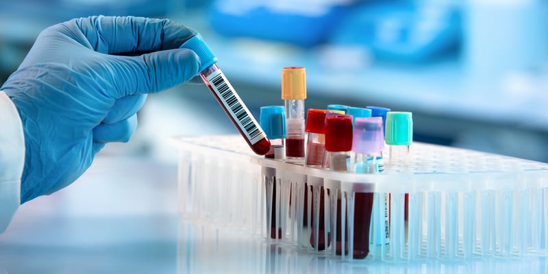 炎性乳腺癌诊断获重大突破！《科学》子刊公布血液生物标志物，液体活检攻克取样难题