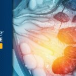 乳腺癌一定要化疗吗？ASCO发布OPTIMA研究：Prosigna检测可帮助2/3患者安全免除化疗