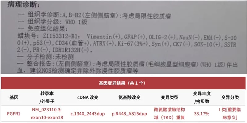 胶质瘤查出FGFR1突变怎么办？深度解析MAPK通路变异型诊疗与靶向药方案