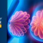 HER2阳性早期乳腺癌新突破：德曲妥珠单抗新辅助治疗显著降低残留病灶，生存期更长