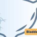 NCCN指南更新：ctDNA-MRD精准指导膀胱癌术后阿替利珠单抗辅助免疫治疗