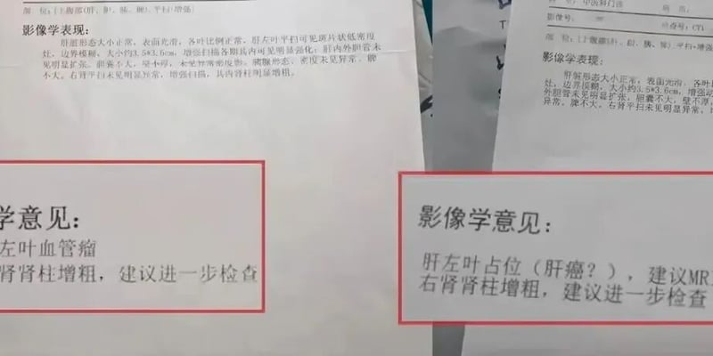 肝血管瘤真的会恶变成肝癌吗？教你看懂CT报告与肝脏占位精准筛查指南