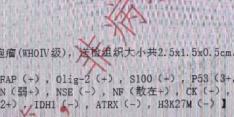 胶质母细胞瘤检出POLD1突变与超突变？解读PD-1免疫治疗新方案与用药指南