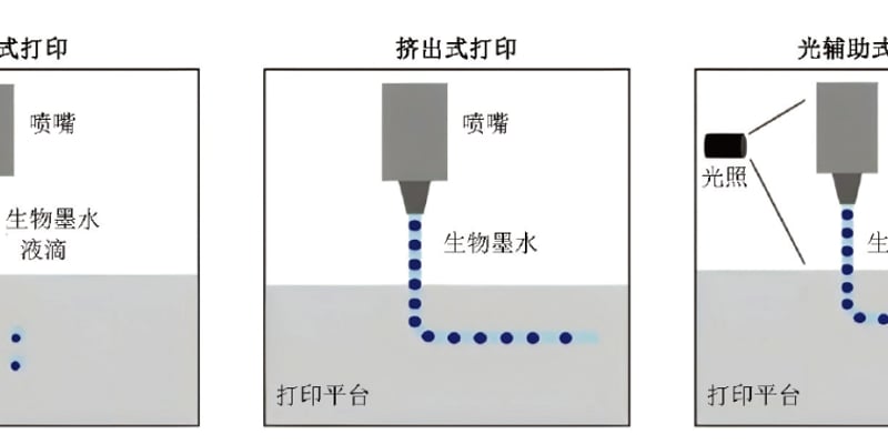 肺癌靶向化疗耐药如何破解？3D生物打印类器官精准药敏试验重塑个体化治疗方案