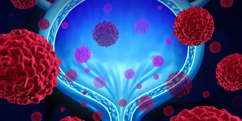 前列腺癌生化复发怎么办？恩扎卢胺联合疗法8年生存率达78.9%且仿制药获批