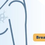 HR+/HER2-乳腺癌化疗怎么选？70基因检测精准预测蒽环类药物获益