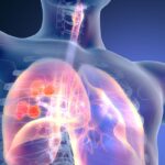 依沃西单抗联合化疗突破27个月总生存期！HARMONi-6研究确立晚期肺鳞癌一线新标准