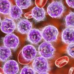 急性淋巴细胞白血病MRD清除新突破：奥加伊妥珠单抗二期临床疗效与生存期数据