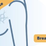 BRCA突变乳腺癌耐药怎么办？创新PARG抑制剂ETX-19477获FDA快速通道认定