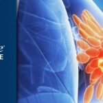 吉达利塞获NCCN指南优选推荐：破解HR+/HER2-乳腺癌内分泌耐药新困局