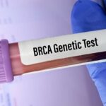 BRCA基因检测结果不明确怎么办？乳腺癌终身患病风险翻倍该如何应对