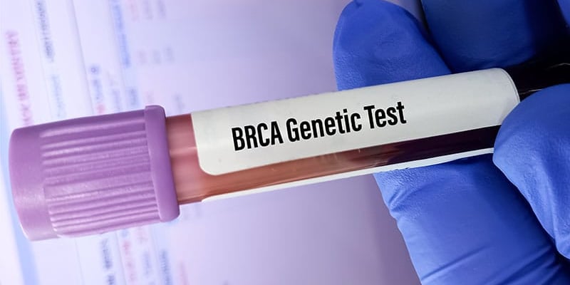 BRCA基因检测结果不明确怎么办？乳腺癌终身患病风险翻倍该如何应对