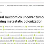 肝癌转移复发如何预防？Science权威破解早期定植机制与潜在干预新靶点