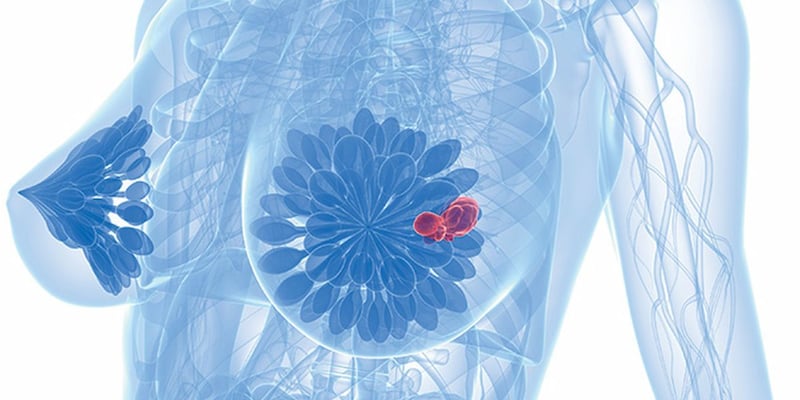 乳腺癌新辅助治疗新突破：度伐利尤单抗联合放疗逆转PD-L1阴性耐药困境
