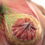 三阴性乳腺癌新辅助免疫治疗怎么选？阿替利珠单抗B-59研究数据与精准用药指南