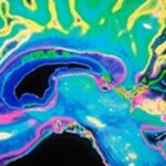 小细胞肺癌一定要做全脑放疗吗？III期临床证实定期核磁监测可替代PCI