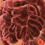 结直肠癌新辅助免疫突破：博腾西利单抗联合方案破解冷肿瘤，术后三年零复发