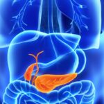 胰腺癌靶向新药Daraxonrasib获批：破局KRAS突变耐药，总生存期翻倍