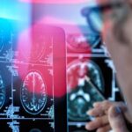 脑肿瘤术中病理难定？英国NHS试点2小时快速基因检测助力精准切除